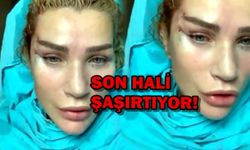 Fransız askısından sonra işte Seda Sayan'ın son hali!