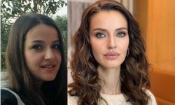 Seni Çok Bekledim dizisinin yıldızı İrem Helvacıoğlu'nun estetiksiz hali şok etti