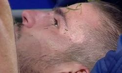 Fenerbahçeli Pelkas hastanelik oldu