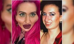 Estetik bağımlısı Ukraynalı model görüntüsü ile şok ediyor!