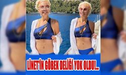 Linet, Photoshop'u biraz abartınca göbek deliği yok oldu!