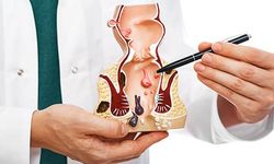 Hayatı kabusa çeviren Hemoroid (Basur) Nedir?