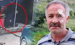 Hayatının şokunu yaşadı! Az kalsın canından oluyordu: 12 gün yoğun bakımda kaldı, bir gözünü kaybetti