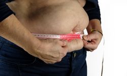 Obezite ameliyatı olacaklar nelere dikkat etmeli?