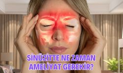 Sinüzitte Ne Zaman Ameliyat Gerekir?