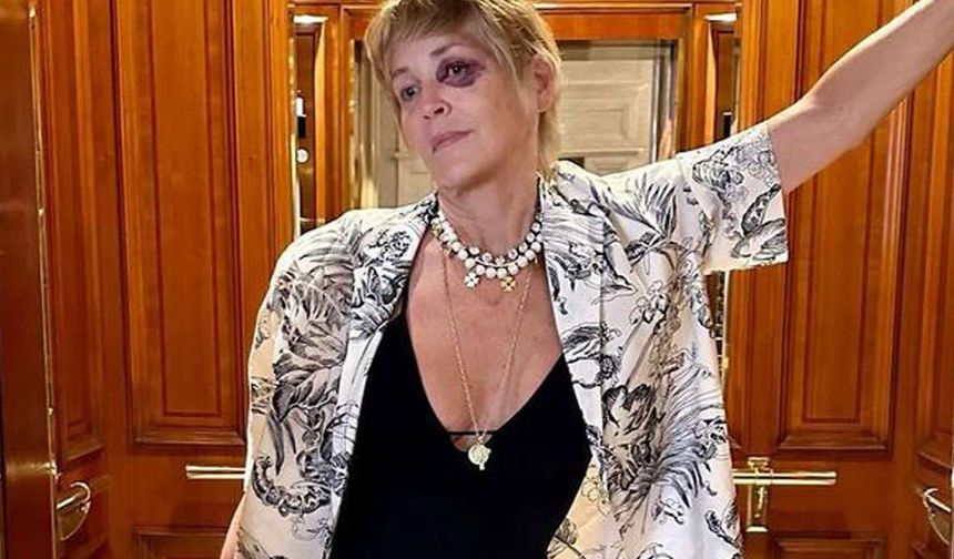 Ödül töreni için Bodrum'a gelen Sharon Stone kaza geçirdi