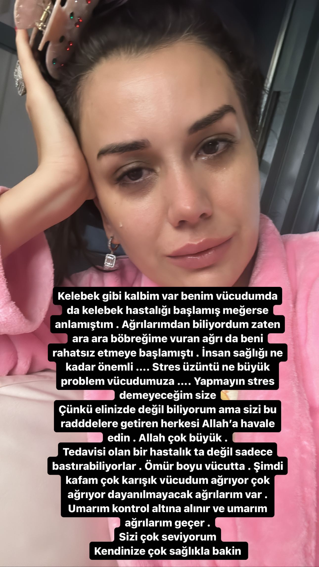 dilan polat lupus