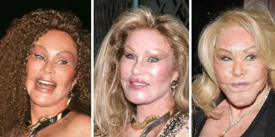 Jocelyn Wildenstein